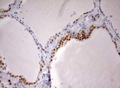 Immunohistochemistry: DDX56 Antibody (OTI2E5) - Azide and BSA Free [NBP2-71964] - Analysis of Human thyroid tissue. (Heat-induced epitope retrieval by 10mM citric buffer, pH6.0, 120C for 3min)