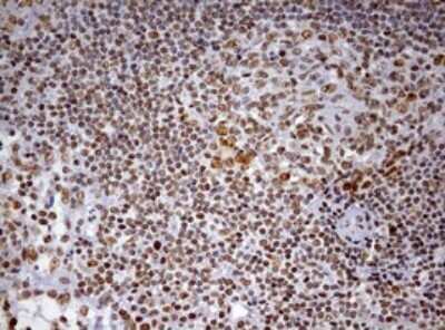 Immunohistochemistry: DDX56 Antibody (OTI2E5) - Azide and BSA Free [NBP2-71964] - Analysis of Human tonsil tissue. (Heat-induced epitope retrieval by 10mM citric buffer, pH6.0, 120C for 3min)