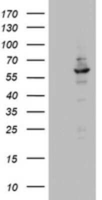 Western Blot: DDX56 Antibody (OTI2E5) - Azide and BSA Free [NBP2-71964] - Analysis of HEK293T cells were transfected with the pCMV6-ENTRY control (Left lane) or pCMV6-ENTRY DDX56.