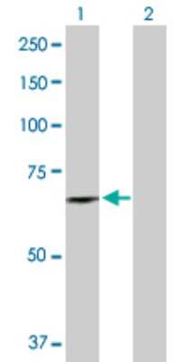 Western Blot: DDX56 Antibody [H00054606-D01P] - Analysis of DDX56 expression in transfected 293T cell line by DDX56 polyclonal antibody.Lane 1: DDX56 transfected lysate(61.60 KDa).Lane 2: Non-transfected lysate.