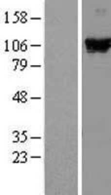 Western Blot: DDX58 Overexpression Lysate (Adult Normal) [NBL1-09808] - Western Blot experiments.  Left-Control; Right -Over-expression Lysate for DDX58.