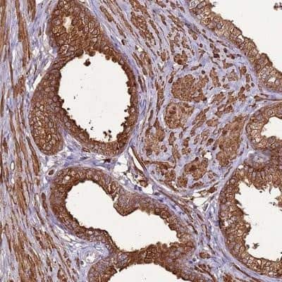Immunohistochemistry-Paraffin: DDX59 Antibody [NBP2-13909] - Staining of human prostate shows strong cytoplasmic and membranous positivity in glandular cells.