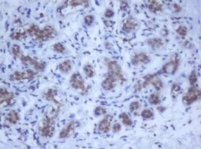Immunohistochemistry: DDX59 Antibody (OTI2G1) - Azide and BSA Free [NBP2-72229] - Analysis of Human breast tissue. (Heat-induced epitope retrieval by 10mM citric buffer, pH6.0, 120C for 3min)