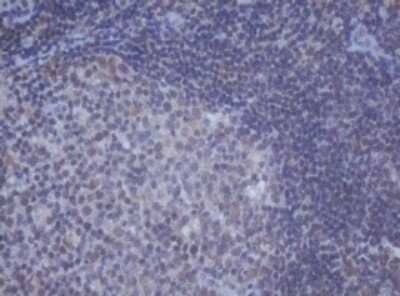 Immunohistochemistry: DDX59 Antibody (OTI2G1) - Azide and BSA Free [NBP2-72229] - Analysis of Human lymph node tissue. (Heat-induced epitope retrieval by 10mM citric buffer, pH6.0, 120C for 3min)