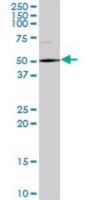 Western Blot: DDX59 Antibody [H00083479-B01P] - Analysis of DDX59 expression in human liver.
