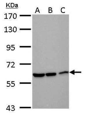 Western Blot: DDX59 Antibody [NBP2-16143] - DDX59 antibody [N3C2], Internal detects DDX59 protein by Western blot analysis.A. 30 ug Neuro2A whole cell lysate/extract. B. 30 ug GL261 whole cell lysate/extract. C. 30 ug C8D30 whole cell lysate/extract. 7.5 % SDS-PAGE. DDX59 antibody, dilution: 1:1000