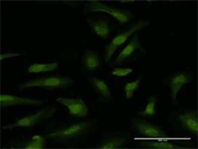 Immunocytochemistry/Immunofluorescence: DDX6 Antibody [H00001656-D01P] - Analysis of antibody to DDX6 on HeLa cell. Antibody concentration 10 ug/ml.