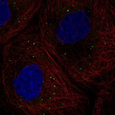 <b>Independent Antibodies Validation. </b>Immunocytochemistry/Immunofluorescence: DDX6 Antibody [NBP1-83249] - Staining of human cell line A-431 shows localization to cytoplasmic bodies.