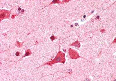 Immunohistochemistry-Paraffin: DDX6 Antibody [NB100-2818] - Staining of paraffin embedded Human Cortex. Antibody at 5 ug/mL. Steamed antigen retrieval with citrate buffer pH 6, AP-staining.