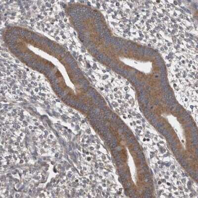 Immunohistochemistry-Paraffin: DDX6 Antibody [NBP1-83249] - Staining of human endometrium shows strong cytoplasmic positivity in glandular cells.