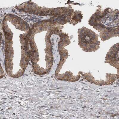 Immunohistochemistry-Paraffin: DDX6 Antibody [NBP1-83249] - Staining of human prostate shows moderate cytoplasmic positivity in glandular cells.