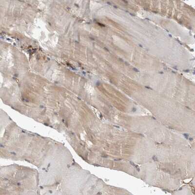 Immunohistochemistry-Paraffin: DDX6 Antibody [NBP1-83249] - Staining of human skeletal muscle shows weak cytoplasmic positivity in myocytes.