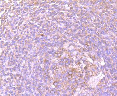 Immunohistochemistry-Paraffin: DDX6 Antibody (JB41-32) [NBP2-75466] - Analysis of paraffin-embedded human tonsil tissue using anti-DDX6 antibody. Counter stained with hematoxylin.