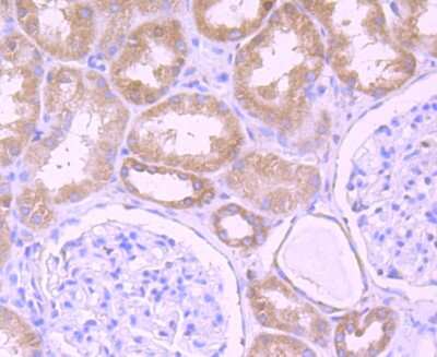 Immunohistochemistry-Paraffin: DDX6 Antibody (JB41-32) [NBP2-75466] - Analysis of paraffin-embedded human kidney tissue using anti-DDX6 antibody. Counter stained with hematoxylin.