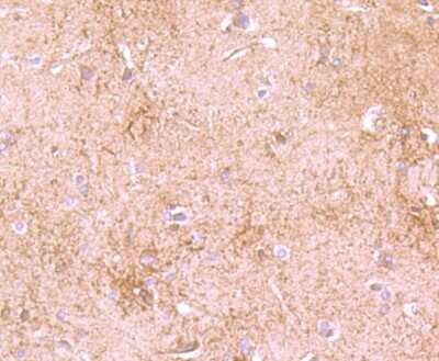 Immunohistochemistry-Paraffin: DDX6 Antibody (JB41-32) [NBP2-75466] - Analysis of paraffin-embedded rat brain tissue using anti-DDX6 antibody. Counter stained with hematoxylin.