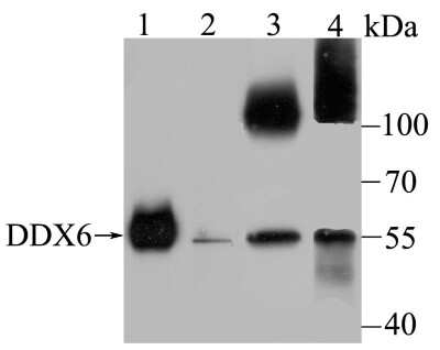 Western Blot: DDX6 Antibody (JB41-32) [NBP2-75466] - Analysis of DDX6 on different lysates using anti-DDX6 antibody at 1/500 dilution.Positive control:Lane 1: Human colon      Lane 2: SH-SY-5YLane 3: SiHa             Lane 4: K562