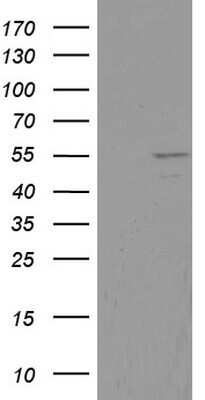Western Blot: DDX6 Antibody (OTI2D6) - Azide and BSA Free [NBP2-70563] - Analysis of HEK293T cells were transfected with the pCMV6-ENTRY control (Left lane) or pCMV6-ENTRY DDX6 .