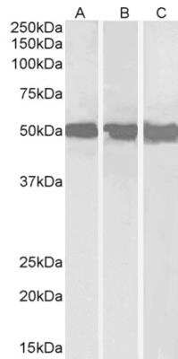 Western Blot: DDX6 Antibody [NB100-2818] - Staining of Daudi (A), Jurkat (B) and HepG2 (C) lysates (35 ug protein in RIPA buffer). Antibody at 0.3 ug/mL. Detected by chemiluminescence.