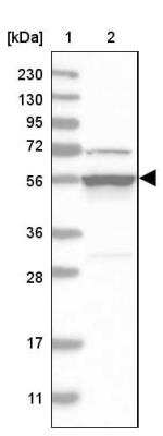 Western Blot: DDX6 Antibody [NBP1-83248] - Lane 1: Marker  [kDa] 230, 130, 95, 72, 56, 36, 28, 17, 11.  Lane 2: Human cell line RT-156