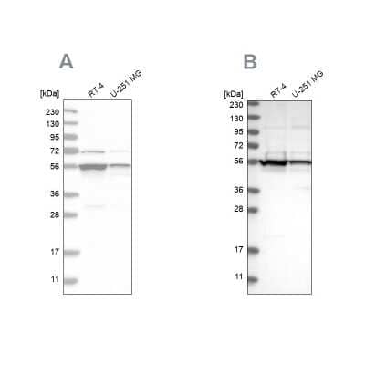 Western Blot: DDX6 Antibody [NBP1-83248] - Analysis using Anti-DDX6 antibody NBP1-83248 (A) shows similar pattern to independent antibody NBP1-83249 (B).