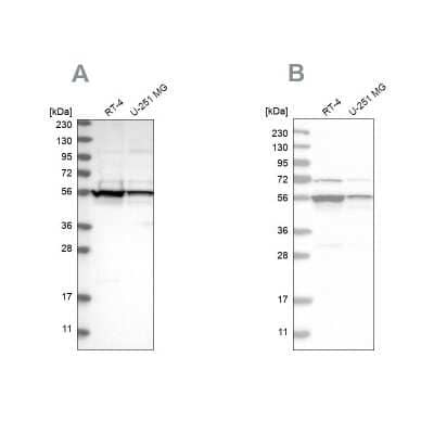 Western Blot: DDX6 Antibody [NBP1-83249] - Analysis using Anti-DDX6 antibody NBP1-83249 (A) shows similar pattern to independent antibody NBP1-83248 (B).