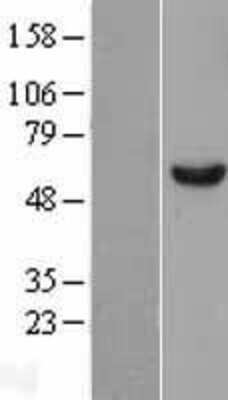 Western Blot: DDX6 Overexpression Lysate (Adult Normal) [NBL1-09810] Left-Empty vector transfected control cell lysate (HEK293 cell lysate); Right -Over-expression Lysate for DDX6.