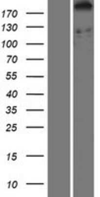 Western Blot DDX60 Overexpression Lysate