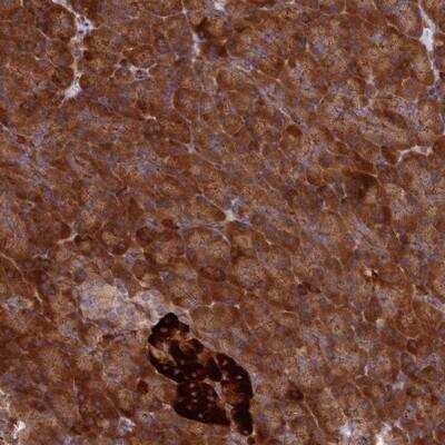 Immunohistochemistry-Paraffin DDX60L Antibody - BSA Free