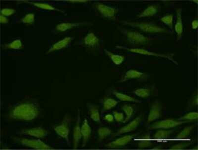 Immunocytochemistry/Immunofluorescence: DEAF1 Antibody [H00010522-D01P] - Analysis of antibody to DEAF1 on HeLa cell. Antibody concentration 10 ug/ml.