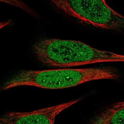 Immunocytochemistry/ Immunofluorescence DEAF1 Antibody