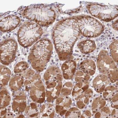 Immunohistochemistry-Paraffin DEAF1 Antibody