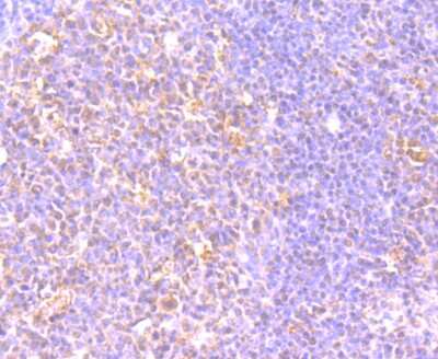 Immunohistochemistry-Paraffin: DEC-205/CD205 Antibody (JB87-35) [NBP2-75467] - Analysis of paraffin-embedded human tonsil tissue using anti-LY75 antibody. Counter stained with hematoxylin.