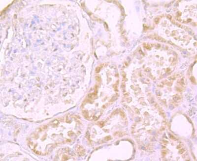 Immunohistochemistry-Paraffin: DEC-205/CD205 Antibody (JB87-35) [NBP2-75467] - Analysis of paraffin-embedded human kidney tissue using anti-LY75 antibody. Counter stained with hematoxylin.