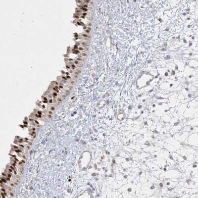 Immunohistochemistry: DEC1 Antibody [NBP2-47488] - Staining of nasopharynx tissue. Shows strong nuclear positivity in respiratory epithelial cells.