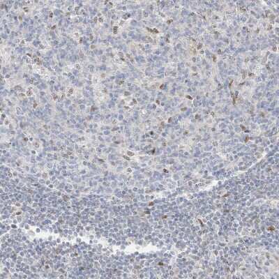 Immunohistochemistry-Paraffin: DEC1 Antibody [NBP2-47488] - Staining of human lymph node shows moderate nuclear positivity in a small subset of cells in non-germinal center.