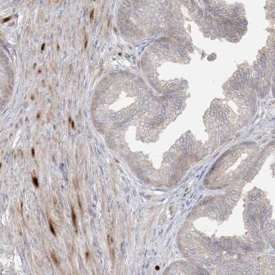 Immunohistochemistry-Paraffin: DEC1 Antibody [NBP2-47488] - Staining of human prostate shows moderate to strong nuclear positivity in smooth muscle cells.