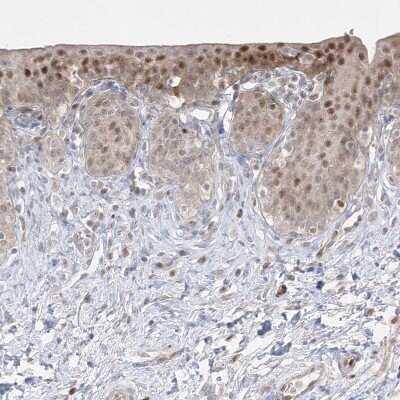 Immunohistochemistry-Paraffin: DEC1 Antibody [NBP2-47488] - Staining of human urinary bladder shows moderate to strong nuclear positivity in urothelial cells.