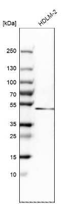 Western Blot: DEC1 Antibody [NBP2-47488] - Analysis in human cell line HDLM-2.