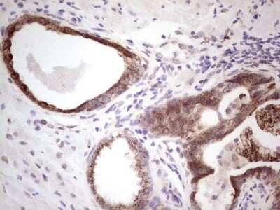 Immunohistochemistry: DEC2/SHARP1 Antibody (OTI5B1) - Azide and BSA Free [NBP2-72203] - Analysis of Human prostate tissue.