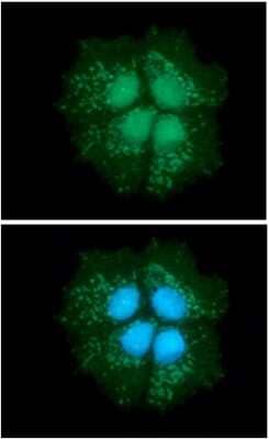 Immunocytochemistry/Immunofluorescence: DECR1 Antibody (3B2) [NBP2-59469] - Analysis of DECR1 in Hep3B cells line, stained with DAPI (Blue) for nucleus staining and monoclonal anti-human   DECR1 antibody (1:100) with goat anti-mouse IgG-Alexa fluor 488 conjugate (Green).