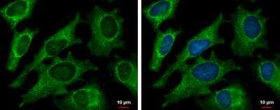 Immunocytochemistry/Immunofluorescence: DECR1 Antibody [NBP1-33103] - HeLa cells were fixed in ice-cold MeOH for 5 min.Green: DECR1 protein stained by DECR1 antibody [N1C3]  diluted at 1:500.Blue: Hoechst 33342 staining.