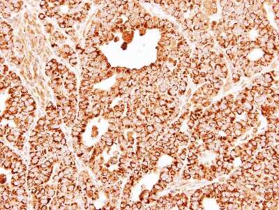 Immunohistochemistry-Paraffin: DECR1 Antibody [NBP1-33103] - NCI-N87 xenograft, using DECR1 antibody at 1:500 dilution. Antigen Retrieval: Citrate buffer, pH 6.0, 15 min.