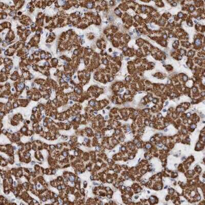 Immunohistochemistry-Paraffin DECR1 Antibody - BSA Free