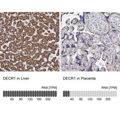 Immunohistochemistry-Paraffin: DECR1 Antibody [NBP1-85263] - Staining in human liver and placenta tissues using anti-DECR1 antibody. Corresponding DECR1 RNA-seq data are presented for the same tissues.