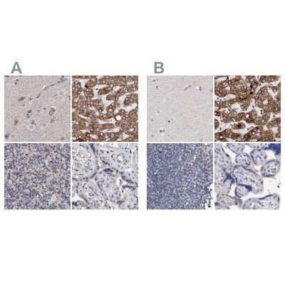 Immunohistochemistry-Paraffin: DECR1 Antibody [NBP1-85263] - Staining of human cerebral cortex, liver, lymph node and placenta using Anti-DECR1 antibody NBP1-85263 (A) shows similar protein distribution across tissues to independent antibody NBP1-85265 (B).