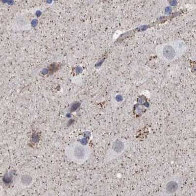 Immunohistochemistry-Paraffin: DECR1 Antibody [NBP1-85263] - Staining of human cerebral cortex.