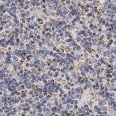 Immunohistochemistry-Paraffin: DECR1 Antibody [NBP1-85263] - Staining of human lymph node.