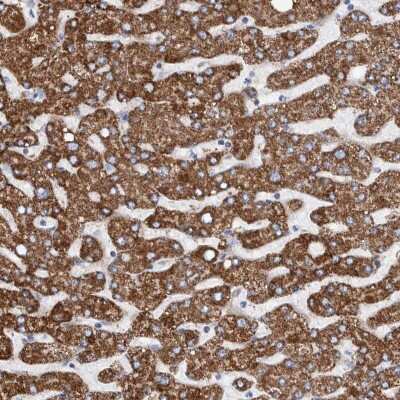 Immunohistochemistry-Paraffin: DECR1 Antibody [NBP1-85264] - Staining of human liver shows strong cytoplasmic positivity in hepatocytes.