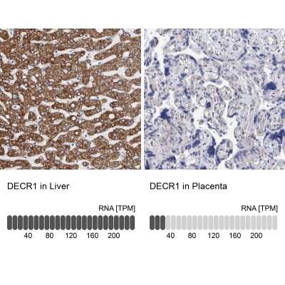 <b>Orthogonal Strategies Validation. </b>Immunohistochemistry-Paraffin: DECR1 Antibody [NBP1-85264] - Staining in human liver and placenta tissues using anti-DECR1 antibody. Corresponding DECR1 RNA-seq data are presented for the same tissues.