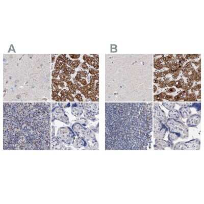 <b>Independent Antibodies Validation. </b>Immunohistochemistry-Paraffin: DECR1 Antibody [NBP1-85264] - Staining of human cerebral cortex, liver, lymph node and placenta using Anti-DECR1 antibody NBP1-85264 (A) shows similar protein distribution across tissues to independent antibody NBP1-85265 (B).